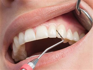 Periodontoloji